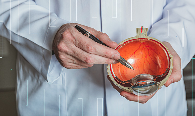 Cirurgia de Catarata